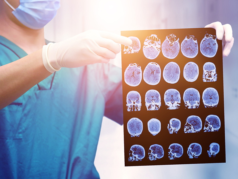 Common specifications for medical film