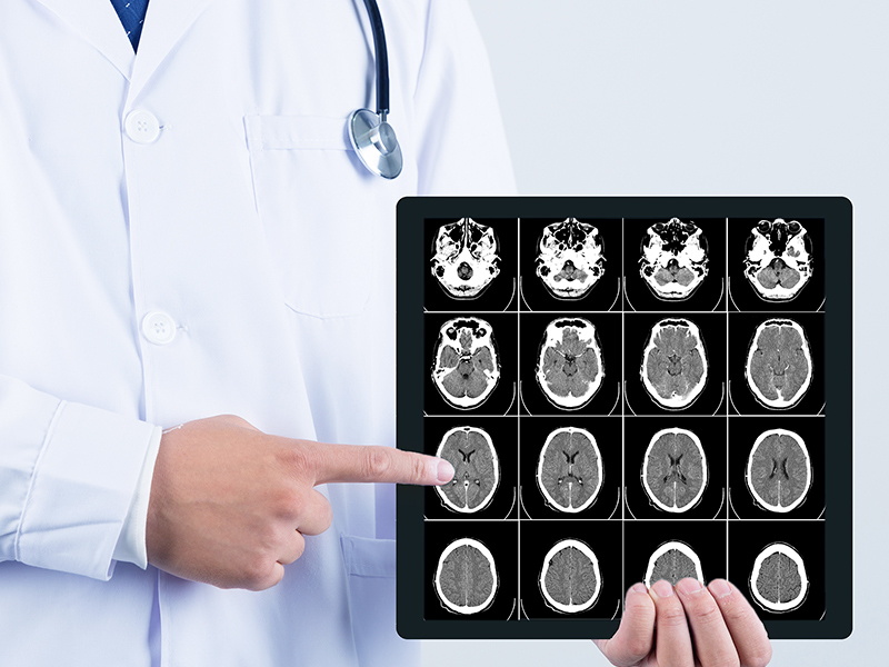 The function and characteristic of medical film